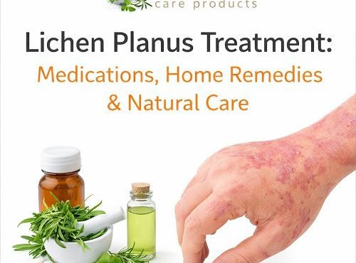 Lichen Planus Treatment