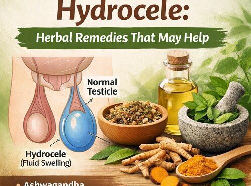 Natural Treatment for Hydrocele