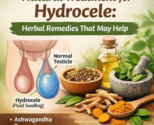 Natural Treatment for Hydrocele