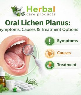 Oral Lichen Planus