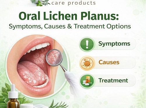 Oral Lichen Planus