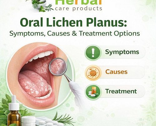 Oral Lichen Planus
