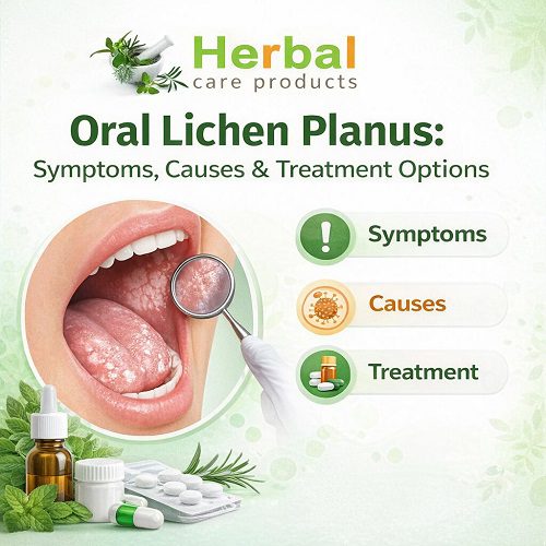 Oral Lichen Planus: Symptoms, Causes & Treatment Options