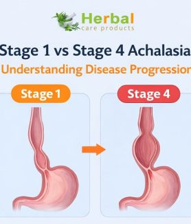 stages of achalasia