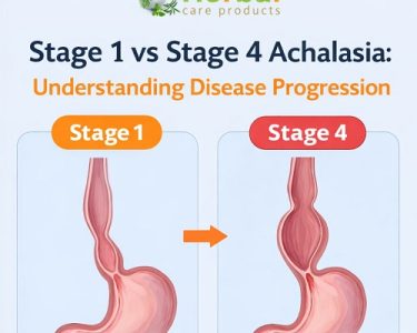 stages of achalasia