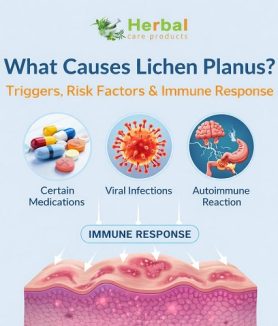 Lichen Planus Causes