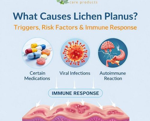 Lichen Planus Causes