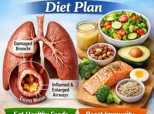 Bronchiectasis Diet Plan