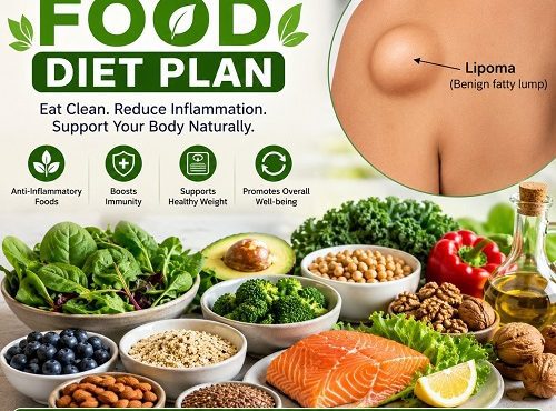 Lipoma Food Diet Plan
