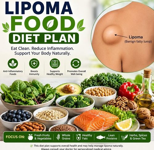 Lipoma Food Diet Plan