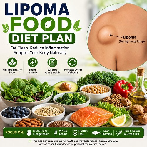 Lipoma Food Diet Plan: What to Eat and Avoid for Faster Results