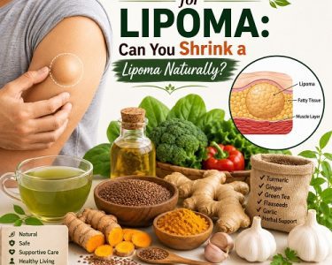 Person examining a soft lipoma on the upper arm with natural herbs, healthy foods, and wellness items illustrating home remedies for lipoma.