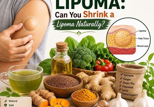 Person examining a soft lipoma on the upper arm with natural herbs, healthy foods, and wellness items illustrating home remedies for lipoma.