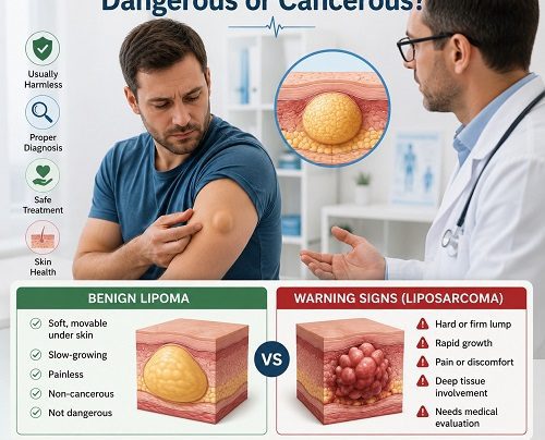 Is lipoma dangerous or cancerous comparison showing a benign lipoma under the skin and medical evaluation by a healthcare professional