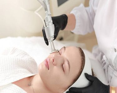 Dermatologist performing laser removal treatment on a patient's skin for seborrheic keratosis removal in a modern clinical setting