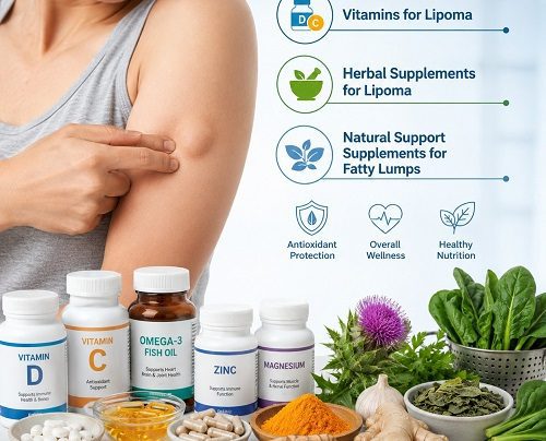 Best supplements for lipoma including vitamins for lipoma, herbal supplements for lipoma, and natural support supplements for fatty lumps