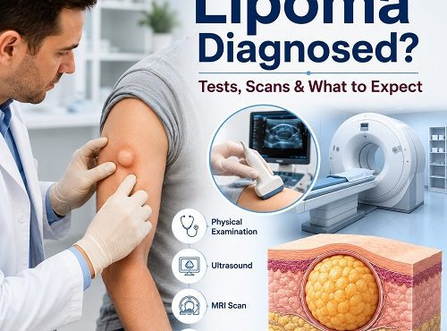 Lipoma diagnosis showing doctor examining a soft fatty lump with ultrasound and MRI evaluation.