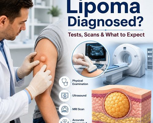 Lipoma diagnosis showing doctor examining a soft fatty lump with ultrasound and MRI evaluation.