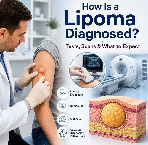 Lipoma diagnosis showing doctor examining a soft fatty lump with ultrasound and MRI evaluation.