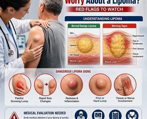 Doctor examining a patient's lipoma while identifying warning signs including rapid growth, pain, and changes in size.