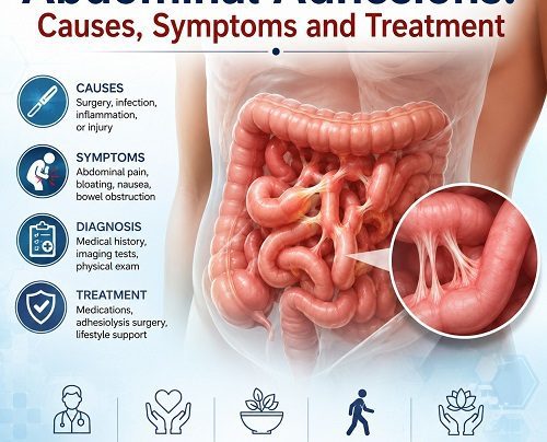 Abdominal adhesions causes, symptoms, and treatment illustration
