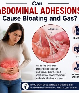 Abdominal adhesions causing bloating and gas by affecting intestinal movement