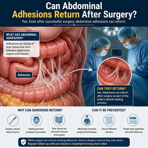 Can Abdominal Adhesions Return After Surgery?