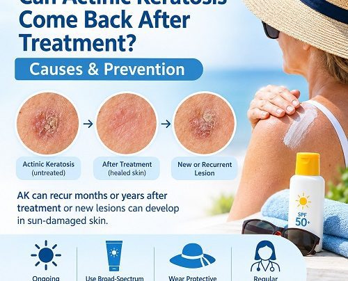 Can Actinic Keratosis Come Back After Treatment