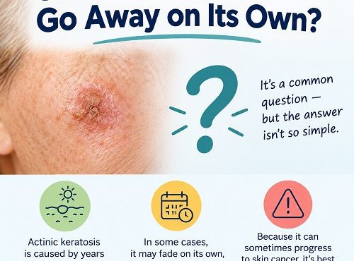 Actinic keratosis appearing as a rough, scaly patch on sun-damaged skin