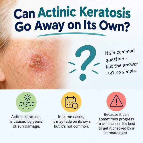 Can Actinic Keratosis Go Away on Its Own?