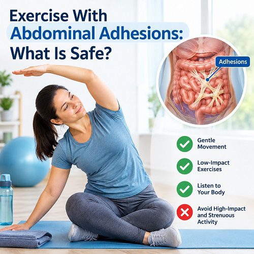 Exercise With Abdominal Adhesions: What Is Safe?