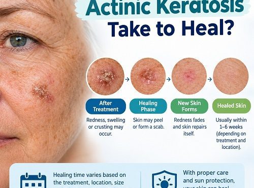 Actinic keratosis healing after treatment with improving red and scaly skin