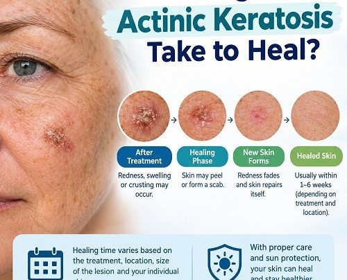 Actinic keratosis healing after treatment with improving red and scaly skin