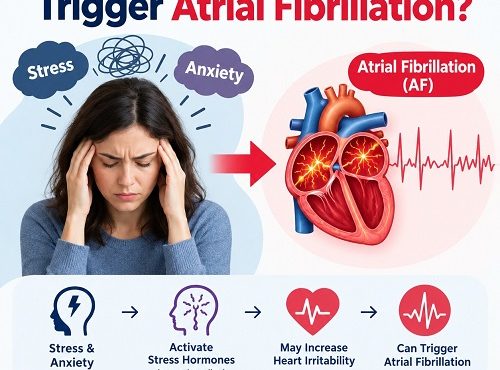 Illustration of a human heart showing atrial fibrillation and the possible effects of stress and anxiety on heart rhythm.