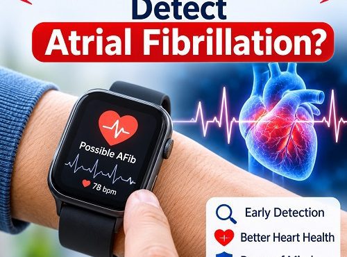 Smartwatch detecting an irregular heart rhythm and displaying an atrial fibrillation alert on its screen.