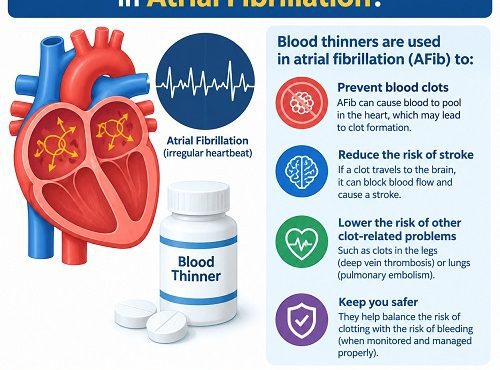 Doctor explaining how blood thinners for atrial fibrillation help prevent blood clots and reduce stroke risk.