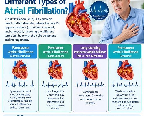 Medical illustration showing the different types of atrial fibrillation and irregular heart rhythms.