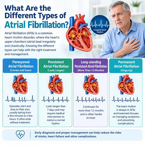 What Are the Different Types of Atrial Fibrillation?