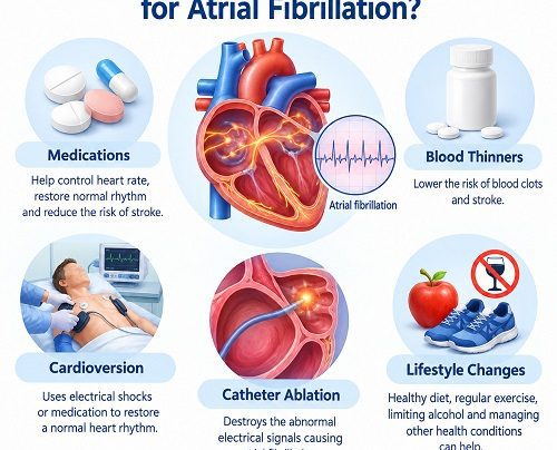 Medical illustration showing atrial fibrillation treatment options, including heart rhythm management, medication and catheter ablation.