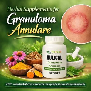 Herbal Supplements for Granuloma Annulare