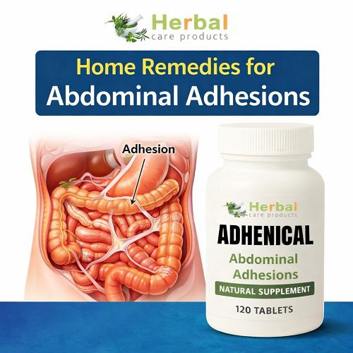 Home Remedies for Abdominal Adhesions Home Remedies for Abdominal Adhesions