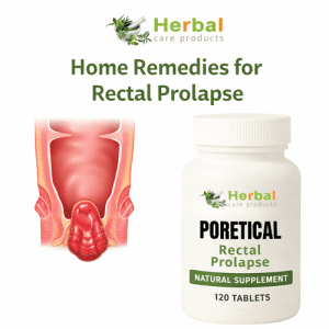 Home Remedies for Rectal Prolapse
