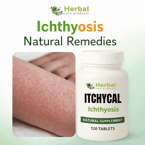 Ichthyosis Natural Remedies Ichthyosis Natural Remedies