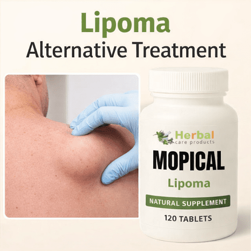 Lipoma Alternative Treatment Lipoma Alternative Treatment