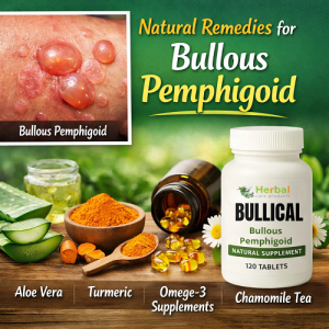 Natural Remedies for Bullous Pemphigoid