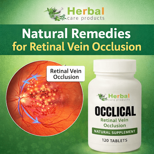 Natural-Remedies-for-Retinal-Vein-Occlusion.png