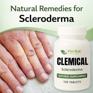 Natural Remedies for Scleroderma