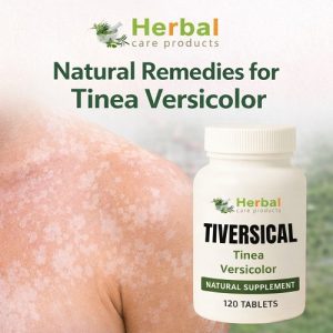 Natural Remedies for Tinea Versicolor