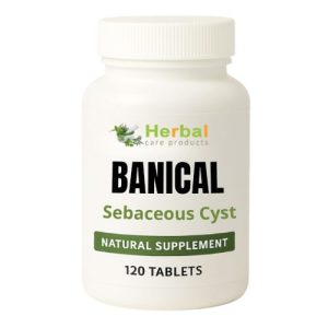 Natural Treatment for Sebaceous Cyst