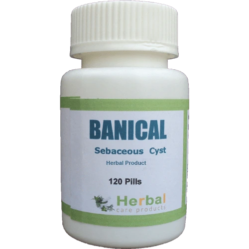 Sebaceous-Cyst-Herbal-Treatment-500x500-1-1